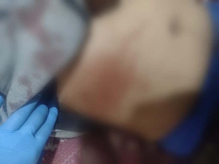 Golpean a bueno menor de edad con un bat de béisbol y una cadena